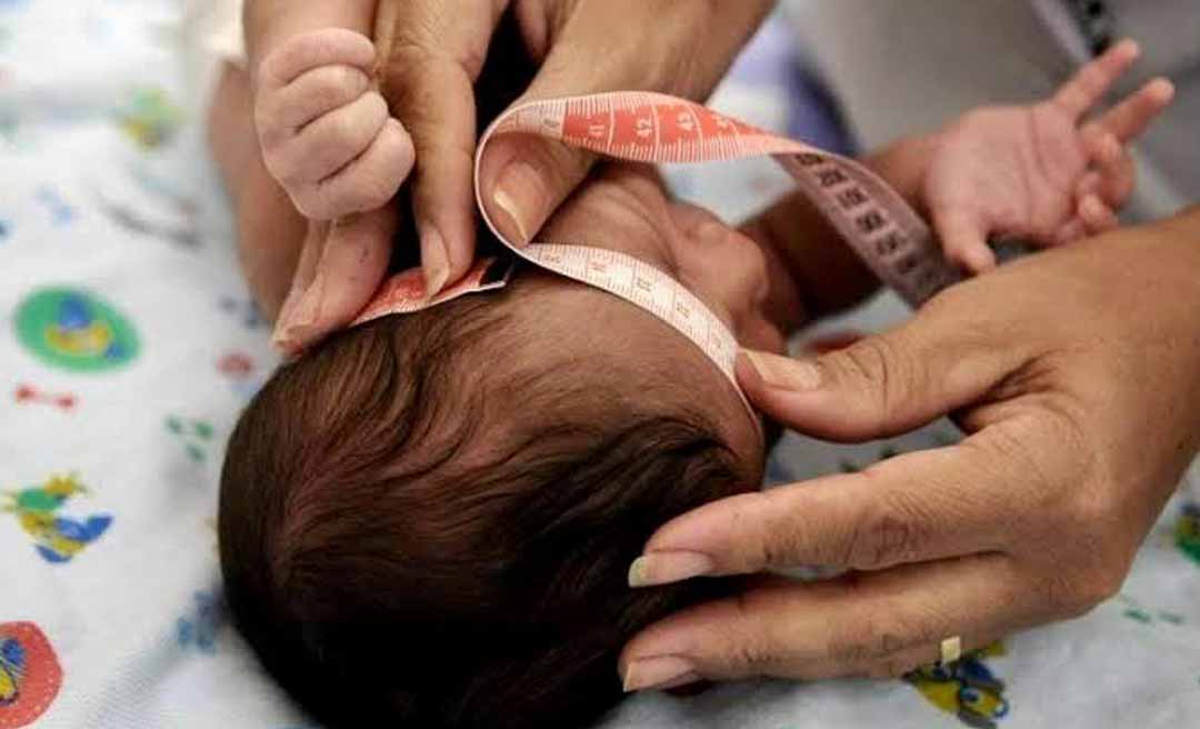 Governo federal autoriza indenização de R$ 60 mil para famílias de crianças com deficiência causada pelo Zika