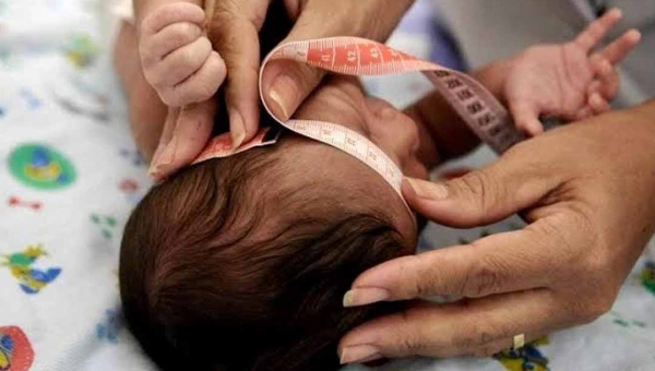 Governo federal autoriza indenização de R$ 60 mil para famílias de crianças com deficiência causada pelo Zika