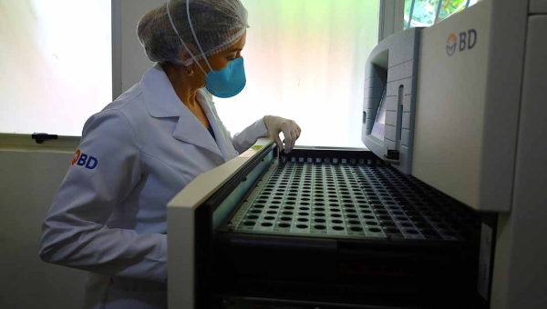 Com novo equipamento, Lacen reduz o tempo de diagnóstico da tuberculose no Acre