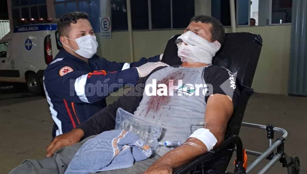 Agricultor sofre acidente com espingarda durante caça no Bujari; parte do cano da arma fica gravado no rosto do homem