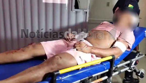 Homem é agredido por engano ao sair de bar no bairro Santa Helena, em Rio Branco