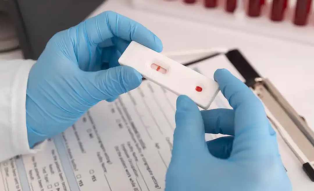 Governo do Acre anuncia distribuição de 47,5 mil testes rápidos para diagnóstico de dengue