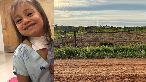 Família rifa terreno para custear tratamento na reversão de traqueostomia de criança de 4 anos