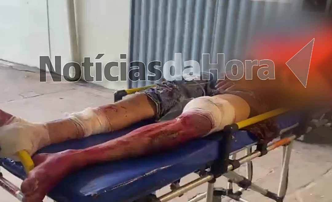 Disfarçados de pedreiros, criminosos atiram contra adolescente e atingem as pernas da vítima