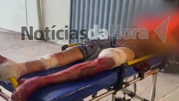 Disfarçados de pedreiros, criminosos atiram contra adolescente e atingem as pernas da vítima