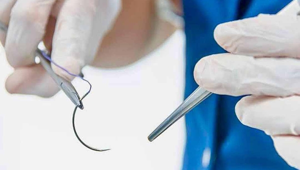 Após ação proposta pelo CRM, MPAC defende inconstitucionalidade de lei que autoriza sutura por enfermeiros