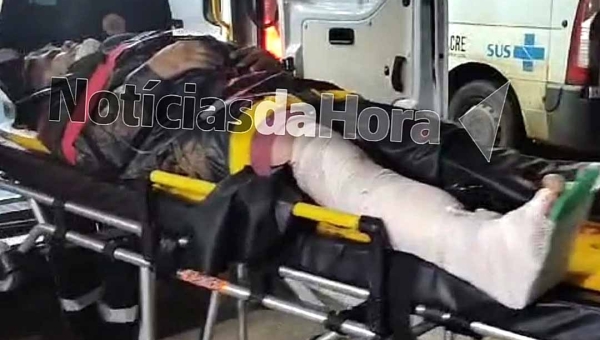 Colisão com carro na Baixada da Habitasa deixa motociclista com fratura na perna e múltiplas escoriações pelo corpo