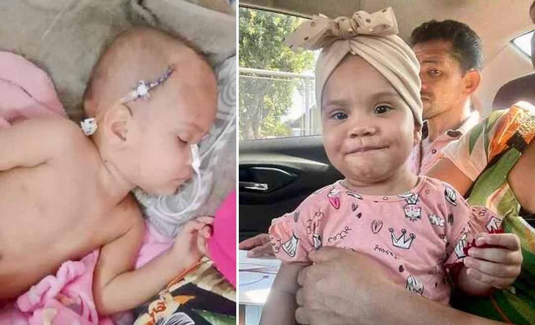 Família faz vaquinha virtual para salvar a pequena Ayla, diagnosticada com doença rara; medicamento custa R$ 120 mil