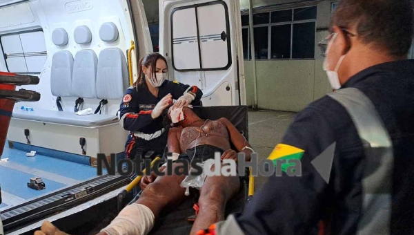 Mulher em situação de rua é atacada por cães e tem rosto desfigurado no bairro da Base, em Rio Branco