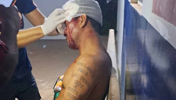 Homem sofre agressão com taco de sinuca na cabeça após briga em bar na zona rural de Porto Acre