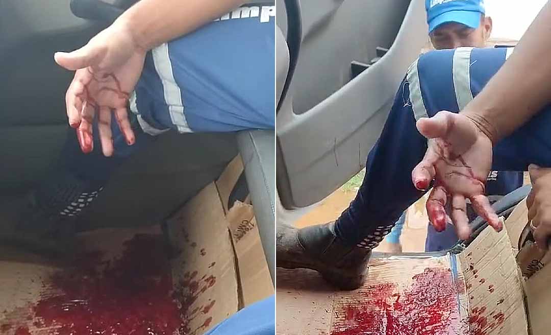 Gari corta o dedo em coleta de lixo em Rio Branco e internauta pede às pessoas que tenham cuidado ao descartar vidro e agulha