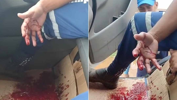 Gari corta o dedo em coleta de lixo em Rio Branco e internauta pede às pessoas que tenham cuidado ao descartar vidro e agulha