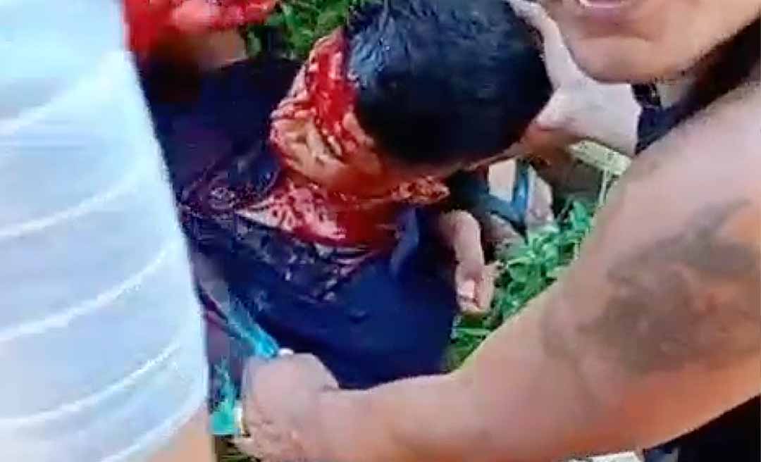 Homem sofre tentativa de homicídio em Boca do Acre; vítima foi atingida por vários facadas e está em estado grave