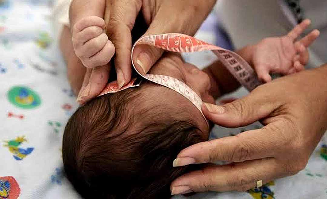 Governo Federal sanciona lei que garante indenização e pensão vitalícia a pessoas com deficiência permanente causada pela síndrome congênita do Zika vírus