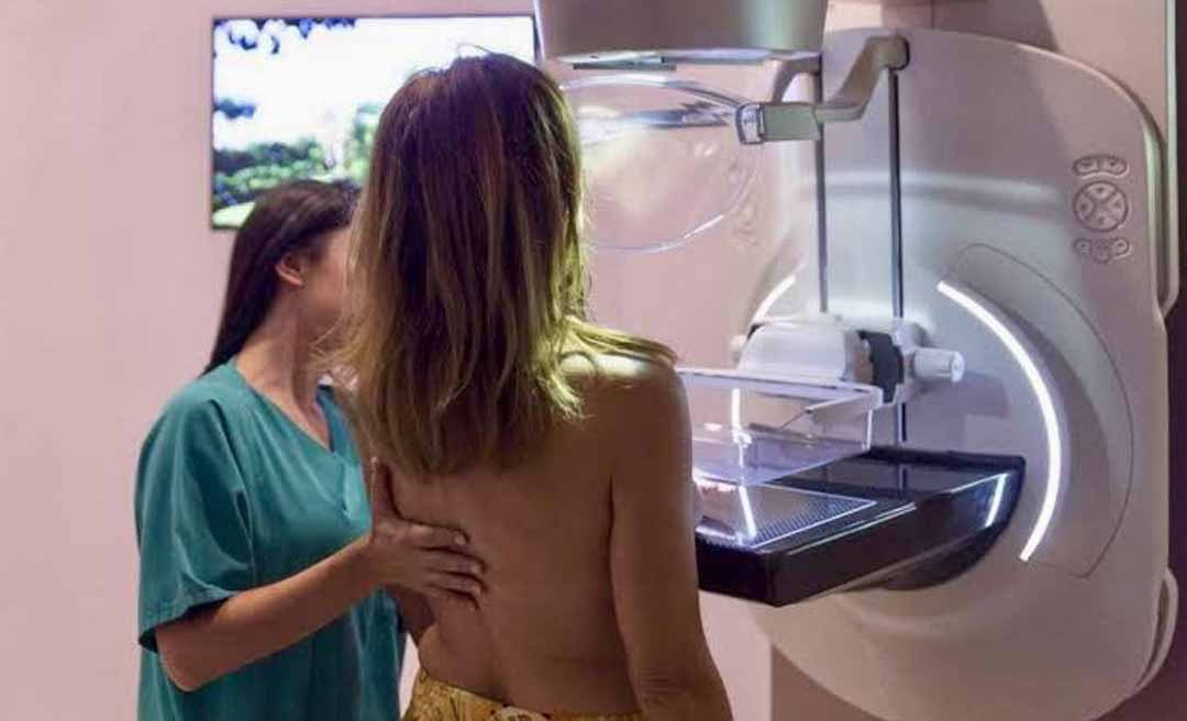 Mais de 500 mulheres não buscaram resultado da mamografia no Acre; retirada do laudo garante diagnóstico precoce do câncer de mama