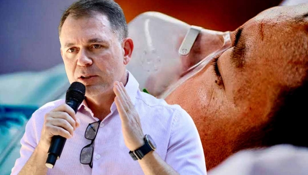 Prefeitura de Rio Branco declara situação de emergência em Saúde pública devido ao avanço das doenças respiratórias na Capital