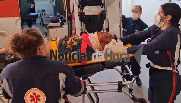 Homem em situação de rua é brutalmente agredido por membros de facção no bairro Vitória, em Rio Branco