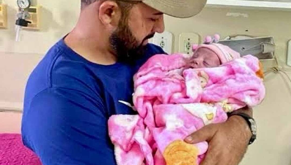 Aurora, bebê vítima de queimaduras em maternidade de Cruzeiro do Sul, aguarda avaliação de enxerto e pode ter dedos amputados