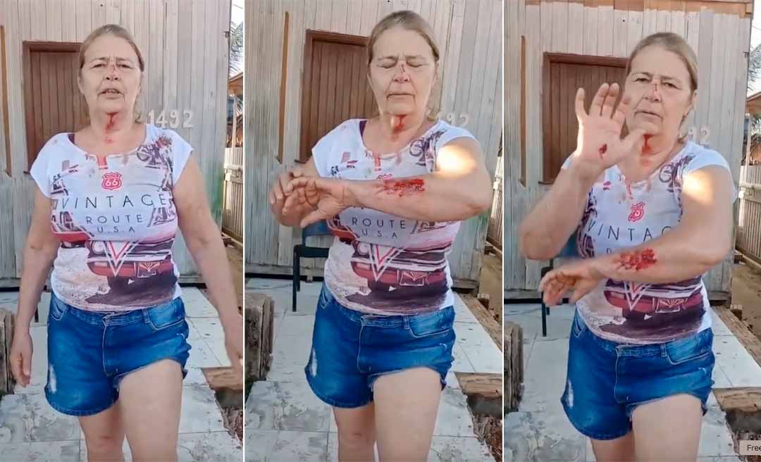 Moradora de Tarauacá sofre queda de moto e faz apelo por melhorias nas ruas do município