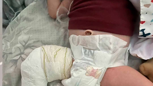 Campanha solidária busca doações para bebê Heitor, de apenas 1 mês, iniciar tratamento ortopédico