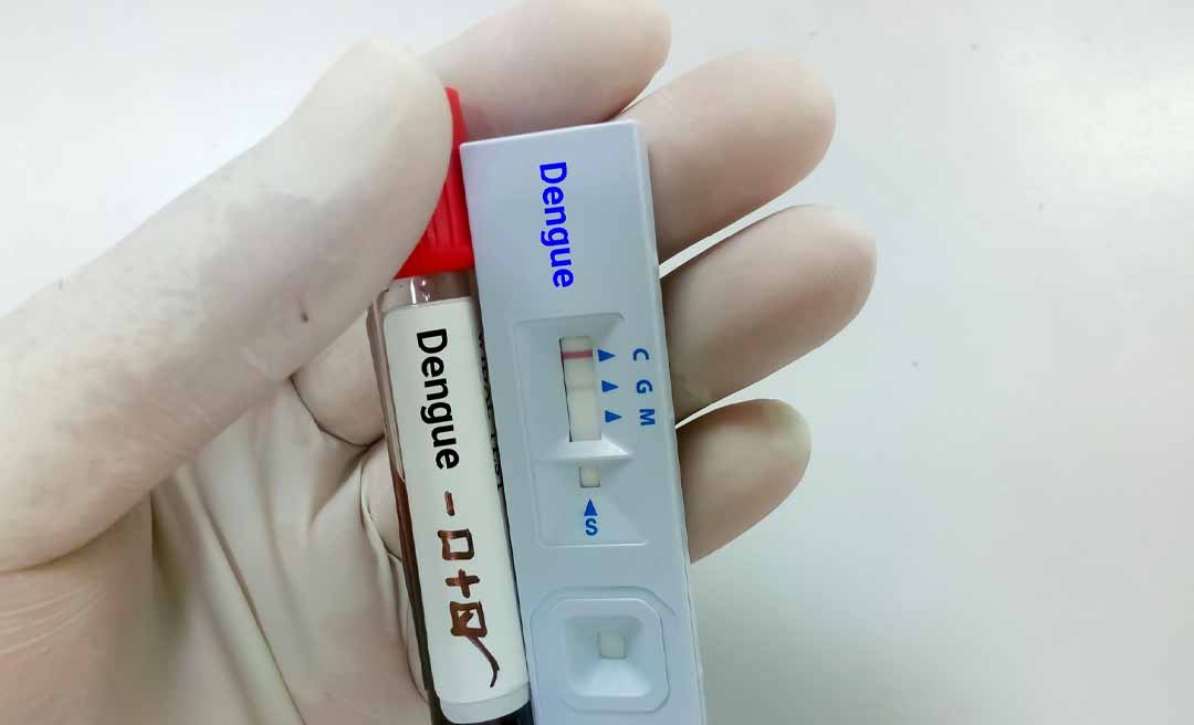 PF deflagra operação para apurar crimes de licitação em aquisição de testes rápidos em prefeitura do interior do Acre