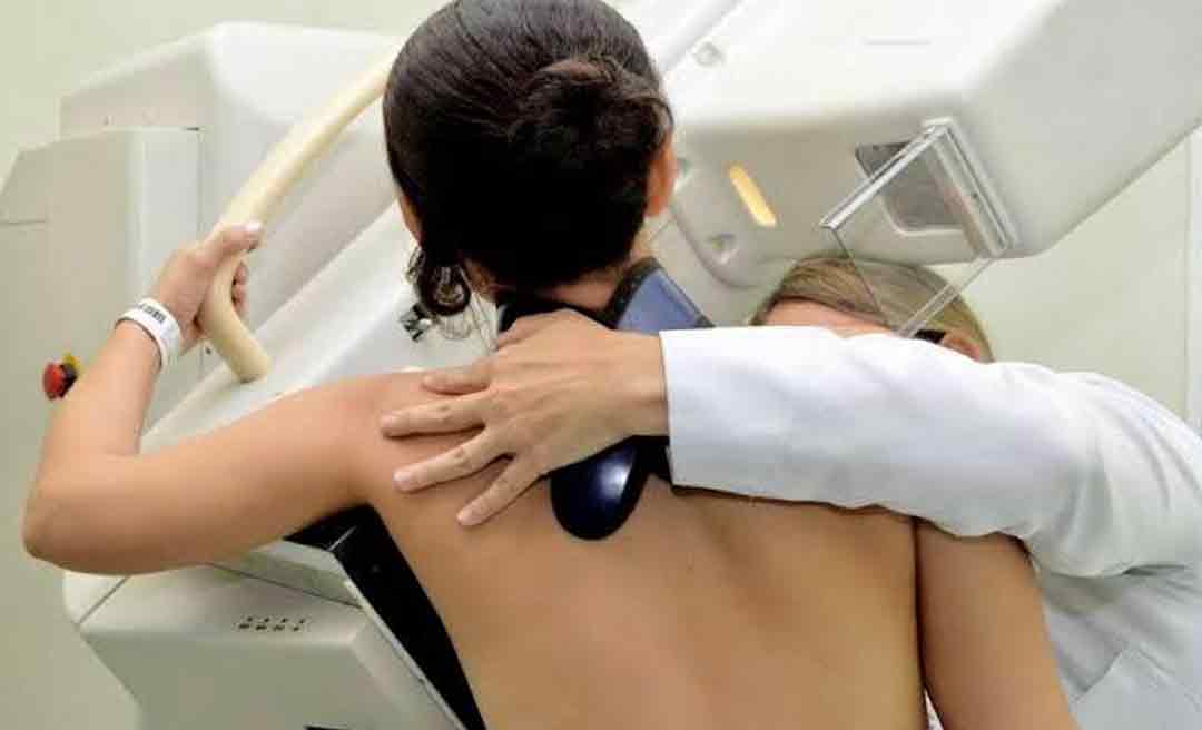 Ministério da Saúde aprova novas diretrizes nacionais para rastreamento do câncer de colo do útero