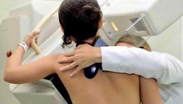 Ministério da Saúde aprova novas diretrizes nacionais para rastreamento do câncer de colo do útero