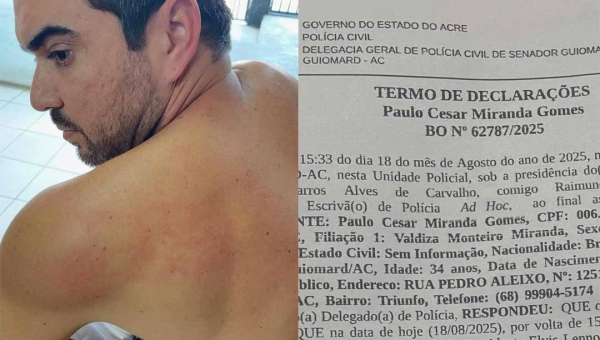 Vereador de Senador Guiomard registra B.O após denúncia de agressão dentro da Câmara por colega de parlamento