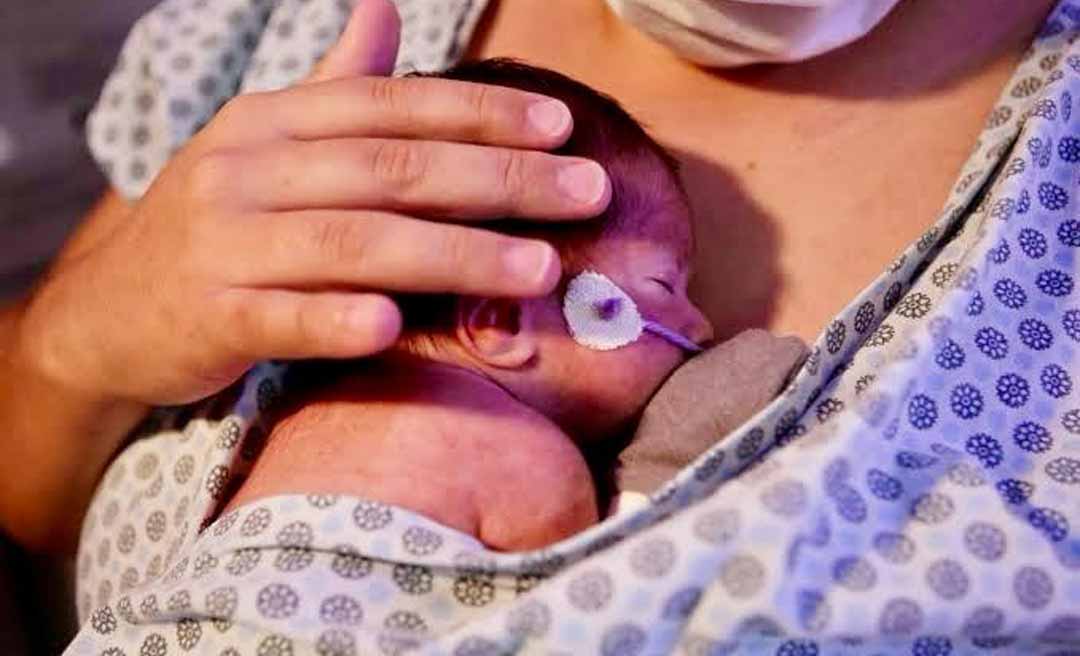Governo sanciona lei que cria o Novembro Roxo e reforça ações contra o parto prematuro