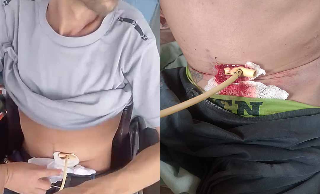 Família denuncia negligência e abandono no atendimento de paciente oncológico no Unacon