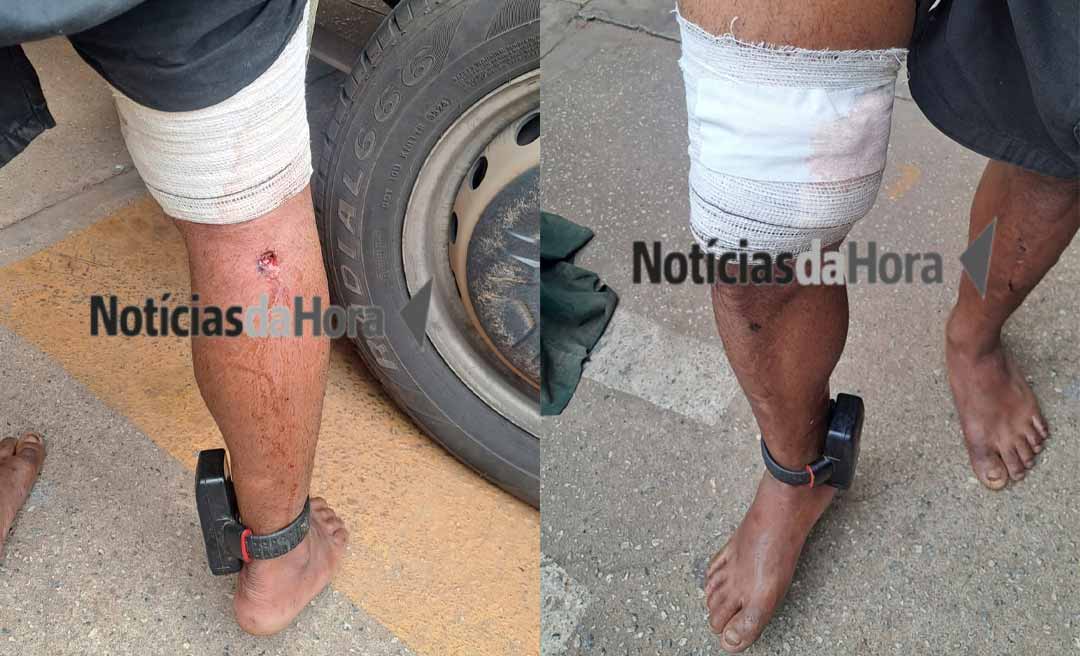 Homem monitorado pela Justiça é baleado em “ato de disciplina” e pede ajuda ao SAMU em Rio Branco