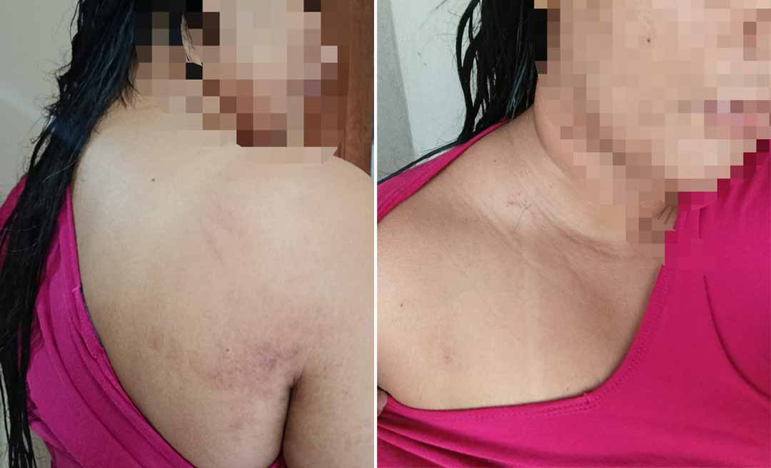 Familiar de paciente internado no Pronto-Socorro da Capital acusa policiais de ação truculenta; denúncias foram formalizadas junto à Corregedoria da PM e ao MPAC