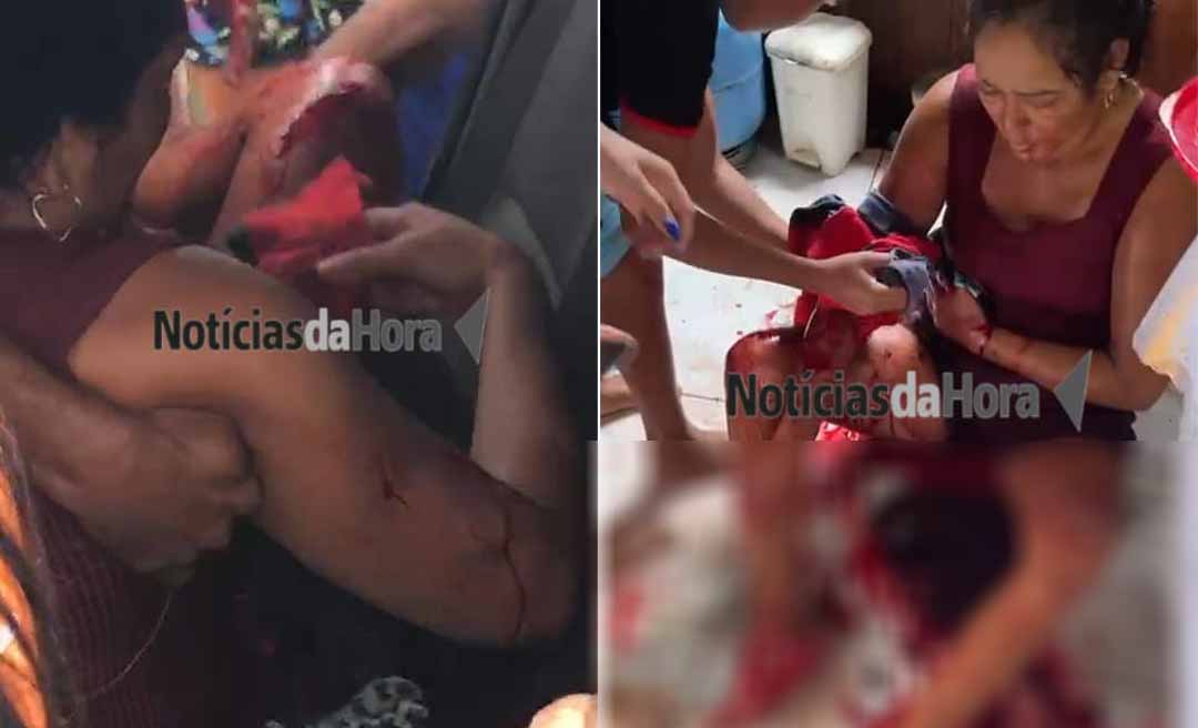Mulher fica gravemente ferida após ser esfaqueada pelo menos 16 vezes pelo ex-companheiro em Sena Madureira