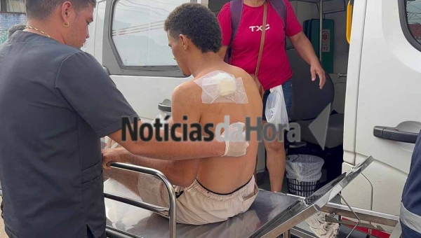 Homem é baleado acidentalmente por amigo durante caçada na zona rural de Xapuri