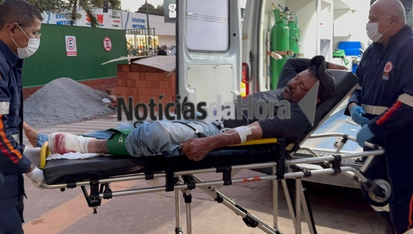 Motociclista sofre fratura exposta após colisão com carro na Vila do Incra, em Porto Acre