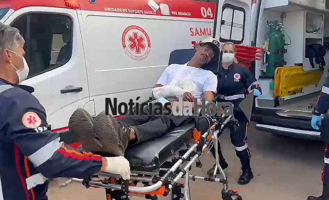 Homem é abordado e baelado no braço na frente de sua residência por desconhecido armado, no Segundo Distrito
