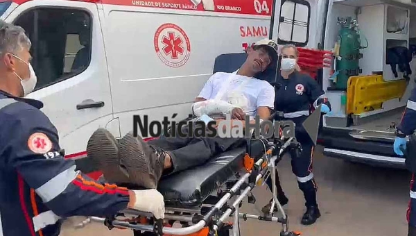 Homem é abordado e baelado no braço na frente de sua residência por desconhecido armado, no Segundo Distrito