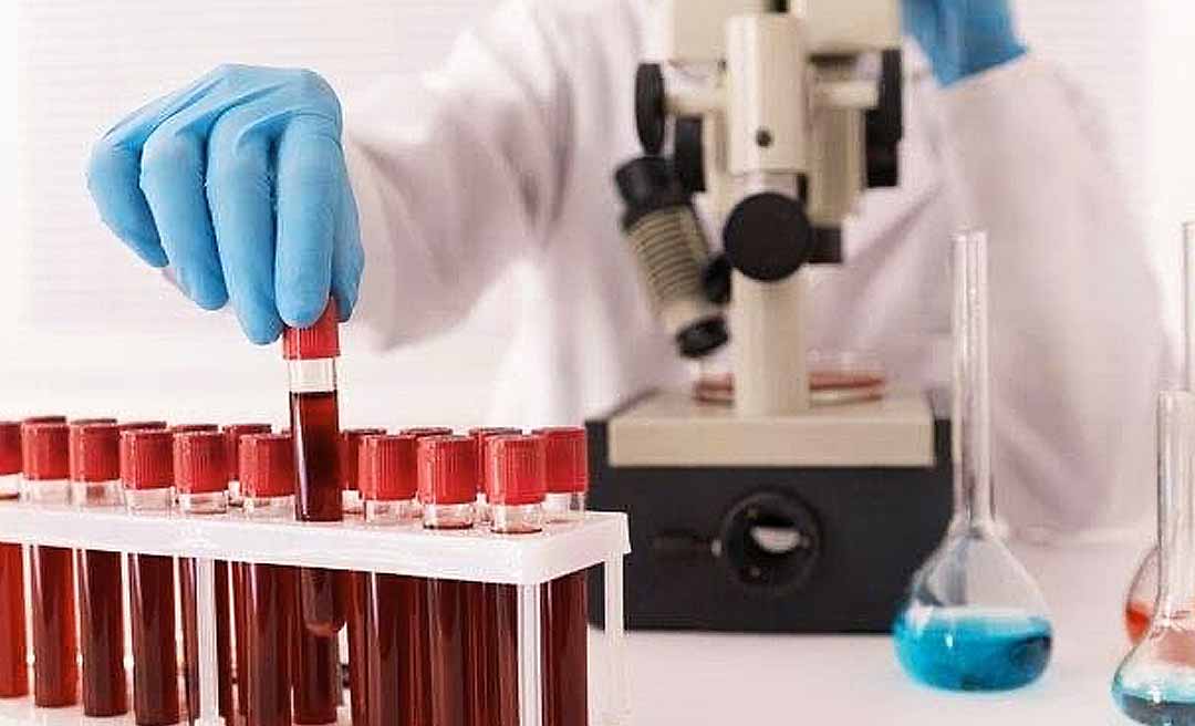 Aditivo de R$ 62,2 milhões prorroga contrato da Sesacre para exames diagnósticos até 2027