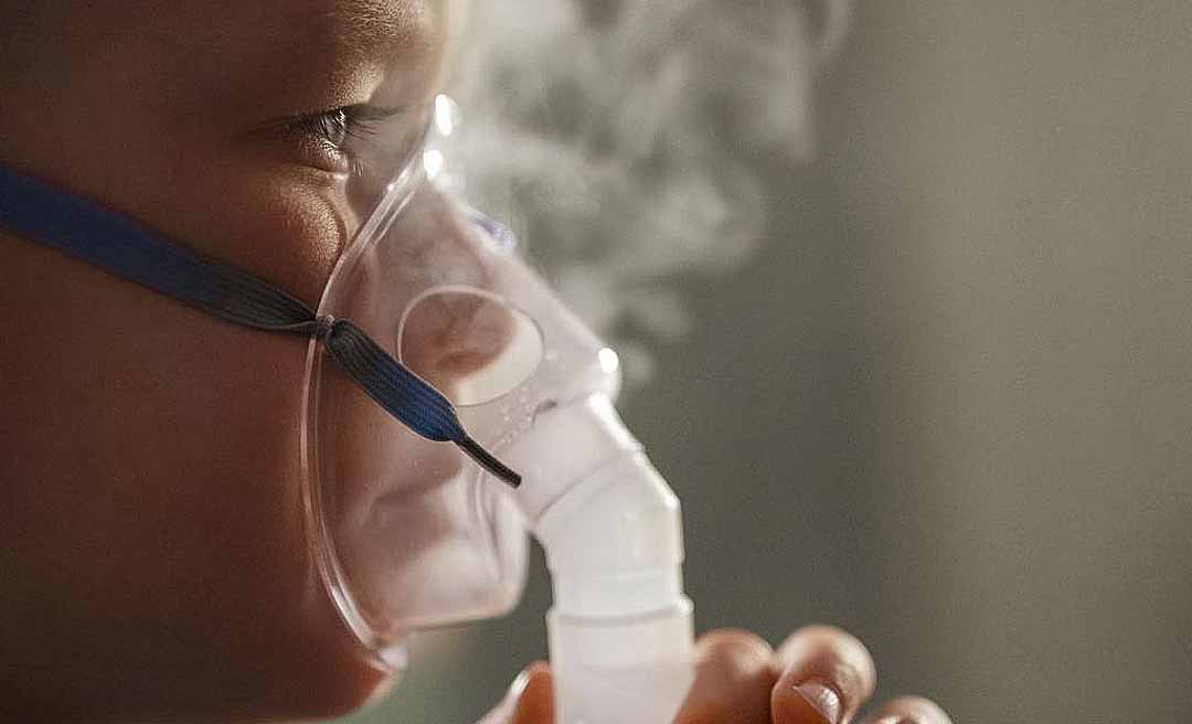 Acre decreta situação de emergência em saúde diante do aumento dos casos de Síndrome Respiratória Aguda Grave